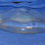 gel implant